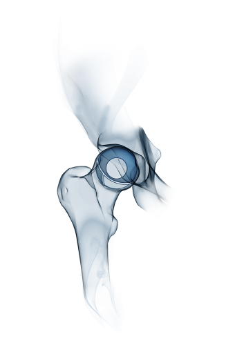 Knochenzemente & Accessoires für Endoprothetik Knochenzemente & Accessoires für Endoprothetik